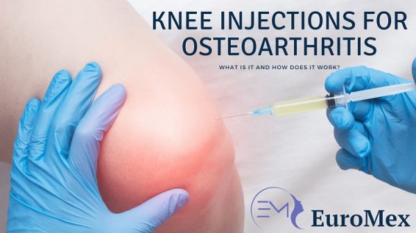 Knee Injections For Osteoarthritis 1 600x337 