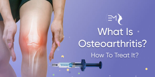 What Is Osteoarthritis?How To Treat It?